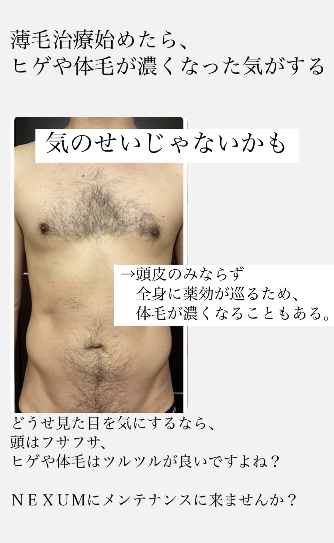【薄毛治療でヒゲや体毛が濃くなった気がする】