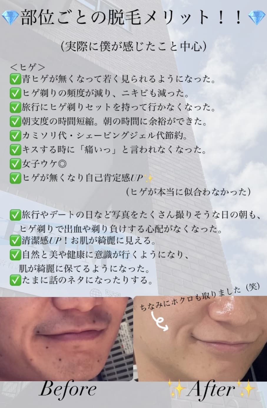 【メンズ脱毛】ヒゲ脱毛のメリット