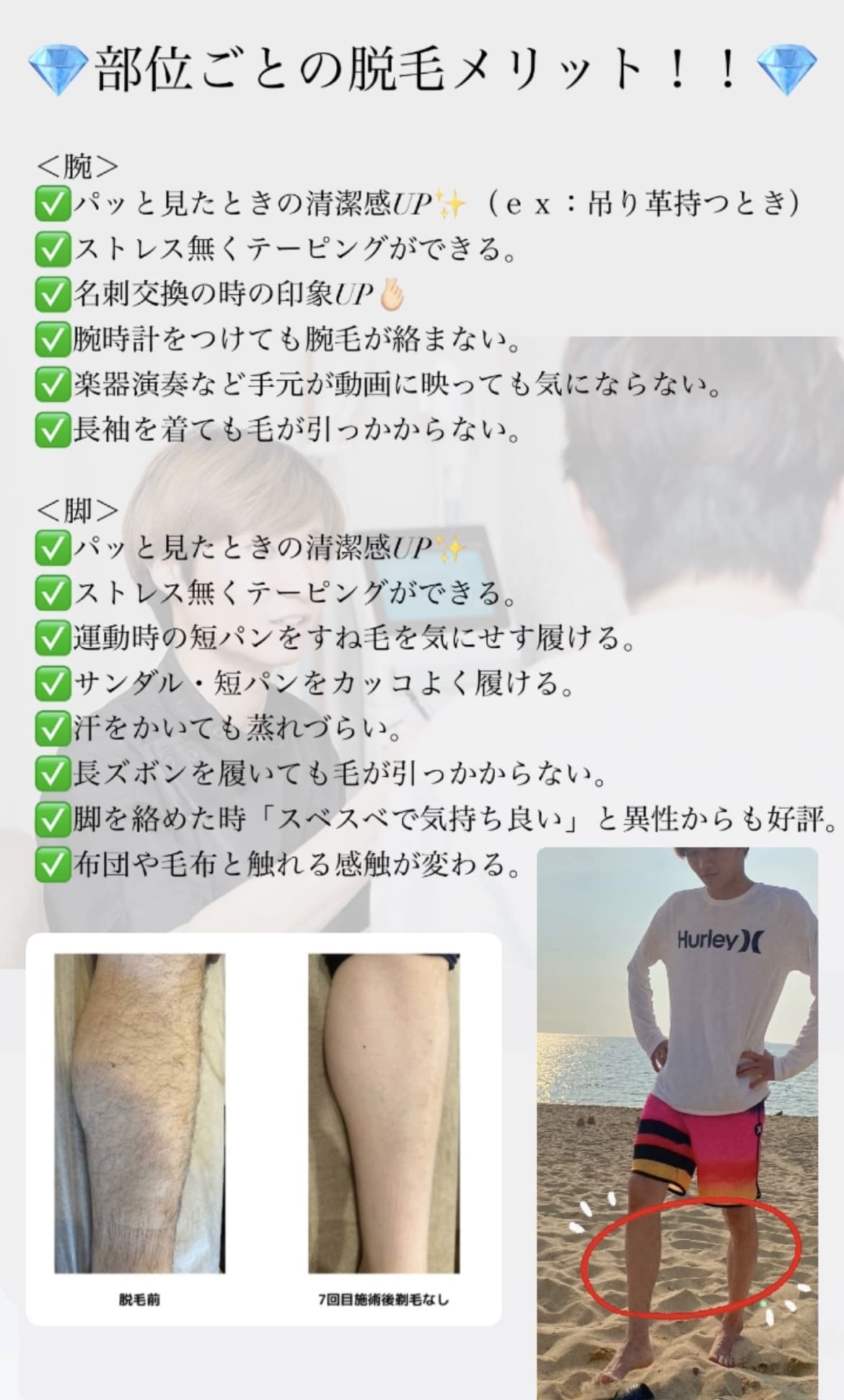 【メンズ脱毛】腕・足脱毛のメリット