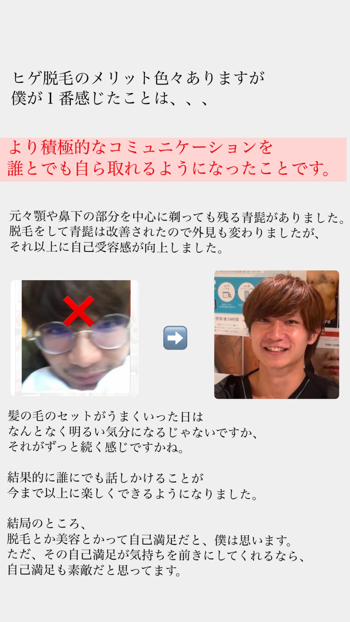 【ヒゲ脱毛】僕が感じた1番のメリット